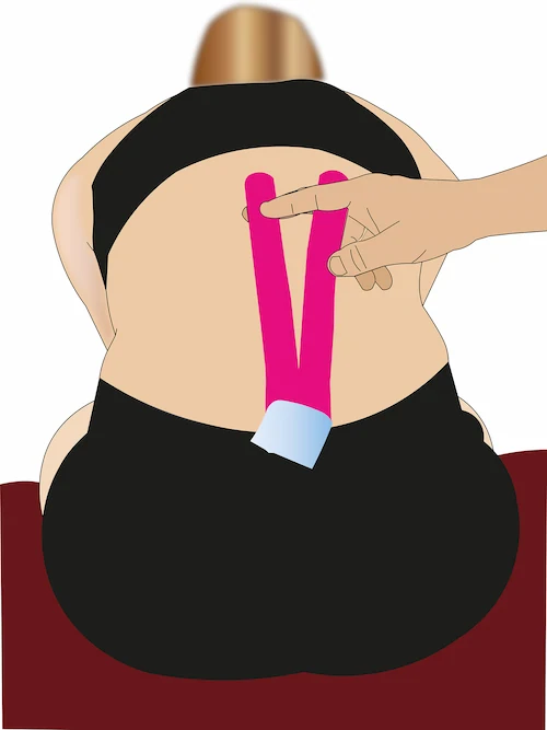 Lumbar spine taping step 3