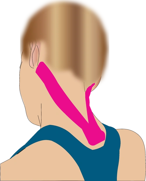 Neck taping step 3