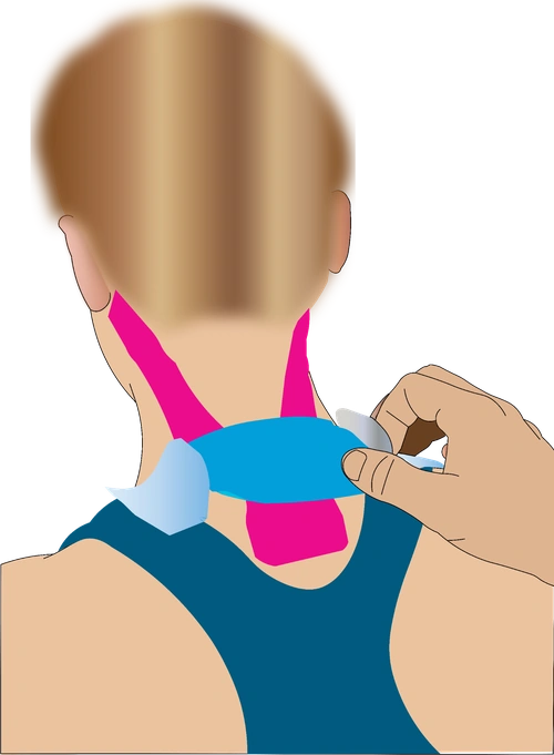 Neck taping step 1