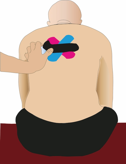 Thoracic spine taping step 4